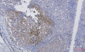 IHC staining of FFPE human tonsil with CD35 antibody. HIER: boil tissue sections in pH8 EDTA for 20 min and allow to cool before testing.