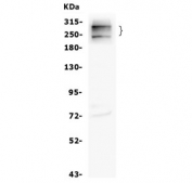 Western blot testing of human HL-60 cell lysate with CD35 antibody. Expected molecular weight: 220-300 kDa.
