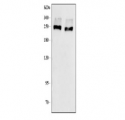 Western blot testing of human TF-1 cell lysate samples with CD35 antibody. Expected molecular weight: 220-300 kDa.