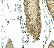 IHC staining of FFPE rat testis with ATRX antibody. HIER: boil tissue sections in pH6, 10mM citrate buffer, for 20 min and allow to cool before testing.