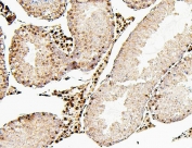 IHC staining of FFPE mouse testis with ATRX antibody. HIER: boil tissue sections in pH6, 10mM citrate buffer, for 20 min and allow to cool before testing.