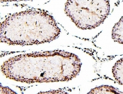 IHC staining of FFPE rat testis with ATRX antibody. HIER: boil tissue sections in pH6, 10mM citrate buffer, for 20 min and allow to cool before testing.