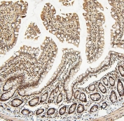 IHC staining of FFPE rat small intestine with ATRX antibody. HIER: boil tissue sections in pH6, 10mM citrate buffer, for 20 min and allow to cool before testing.