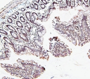 IHC staining of FFPE rat small intestine with ATRX antibody. HIER: boil tissue sections in pH6, 10mM citrate buffer, for 20 min and allow to cool before testing.