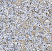 IHC staining of FFPE human seminoma testis tissue with HLA-DRA antibody. HIER: boil tissue sections in pH6, 10mM citrate buffer, for 20 min and allow to cool before testing.