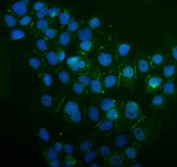 Immunofluorescent staining of human A431 cells with IQGAP1 antibody (green) and DAPI nuclear stain (blue). HIER: boil tissue sections in pH6, 10mM citrate buffer, for 20 min and allow to cool before testing.