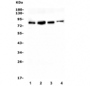 Western blot testing of 1) rat brain, 2) rat liver, 3) mouse brain and 4) mouse Neuro-2a lysate with IRAK1 antibody. Predicted molecular weight 68-76 kDa.