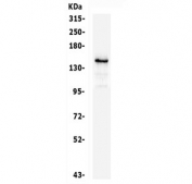 Western blot testing of human A549 cell lysate with c-Kit antibody. Observed molecular weight: ~120/145 kDa (precusor/mature).
