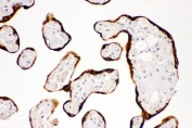 IHC staining of FFPE human placenta with c-Kit antibody. HIER: boil tissue sections in pH6, 10mM citrate buffer, for 20 min and allow to cool before testing.