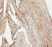 IHC staining of FFPE mouse heart with LPP antibody. HIER: boil tissue sections in pH6, 10mM citrate buffer, for 20 min and allow to cool before testing.