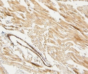 IHC staining of FFPE rat heart with LPP antibody. HIER: boil tissue sections in pH6, 10mM citrate buffer, for 20 min and allow to cool before testing.