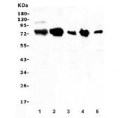 Western blot testing of 1) human placenta, 2) rat ovary, 3) rat heart, 4) mouse ovary and 5) mouse heart lysate with LPP antibody. Predicted molecular weight: ~66 kDa but is routinely observed at 80~85 kDa.