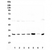 Western blot testing of human 1) placenta, 2) MCF7, 3) HeLa, 4) Caco-2, 5) U-2 OS and 6) ThP-1 lysate with LRTOMT antibody. Expected molecular weight: 28-32 kDa.
