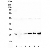 Western blot testing of 1) rat brain, 2) rat ovary, 3) rat heart, 4) rat lung, 5) mouse brain and 6) mouse lung lysate with LRTOMT antibody. Expected molecular weight: 28-32 kDa.