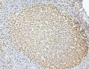 IHC staining of FFPE human tonsil with MCM2 antibody. HIER: boil tissue sections in pH6, 10mM citrate buffer, for 20 min and allow to cool before testing.