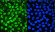 IF/ICC staining of FFPE human A431 cells with MCM2 antibody (green) at 2ug/ml and DAPI nuclear stain (blue). HIER: steam section in pH6 citrate buffer for 20 min.