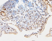 IHC staining of FFPE mouse lymph tissue with MCM2 antibody. HIER: boil tissue sections in pH6, 10mM citrate buffer, for 20 min and allow to cool before testing.