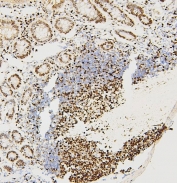 IHC staining of FFPE rat lymph tissue with MCM2 antibody. HIER: boil tissue sections in pH6, 10mM citrate buffer, for 20 min and allow to cool before testing.