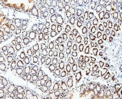 IHC staining of FFPE rat intestinal tissue with MCM2 antibody. HIER: boil tissue sections in pH6, 10mM citrate buffer, for 20 min and allow to cool before testing.