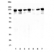 Western blot testing of human 1) Caco-2, 2) HEK293, 3) ThP-1, 4) K562, 5) rat ovary, 6) mouse ovary and 7) mouse NIH 3T3 lysate with MCM2 antibody. Predicted molecular weight: 100~130 kDa.