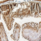 IHC staining of FFPE rat intestine with PXR/NR1I2 antibody. HIER: boil tissue sections in pH6, 10mM citrate buffer, for 20 min and allow to cool before testing.