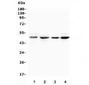 Western blot testing of human 1) rat liver, 2) mouse liver, 3) mouse thymus and 4) mouse testis lysate with PXR/NR1I2 antibody. Predicted molecular weight: ~50 kDa.