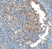 IHC staining of FFPE human tonsil tissue with PCNA antibody. HIER: boil tissue sections in pH8 EDTA for 20 min and allow to cool before testing.
