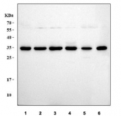 Western blot testing of 1) human HeLa, 2) human MCF7, 3) human 293T, 4) human HepG2, 5) rat PC-12 and 6) mouse NIH 3T3 cell lysate with PCNA antibody. Predicted molecular weight ~29 kDa, routinely observed at 29~36 kDa.