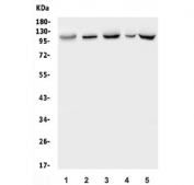 Western blot testing of 1) human U-87 MG, 2) rat spleen, 3) mouse thymus, 4) mouse lung and 5) mouse SP2/0 lysate with Polycystin 2 antibody. Predicted molecular weight: ~110 kDa.