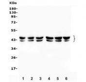 Western blot testing of human 1) HEK293, 2) A549, 3) Caco-2, 4) PC-4, 5) K562 and 6) HeLa cell lysate with PRMT1 antibody. Expected molecular weight: 40-45 kDa.