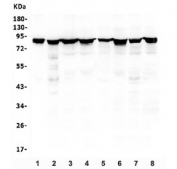 Western blot testing of human 1) placenta, 2) Caco-2, 3) U-2 OS, 4) K562, 5) A431, 6) PC-3, 7) HepG2 and 8) HeLa lysate with Radixin antibody. Predicted molecular weight: ~69 kDa, routinely observed at ~82 kDa.