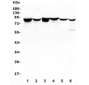 Western blot testing of 1) rat liver, 2) rat brain, 3) mouse lung, 4) mouse liver, 5) mouse brain and 6) mouse Neuro-2a lysate with Radixin antibody. Predicted molecular weight: ~69 kDa, routinely observed at ~82 kDa.