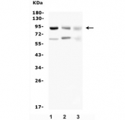 Western blot testing of 1) human HL-60, 2) rat C6 and 3) mouse SP2/0 lysate with SUZ12 antibody. Expected molecular weight 83~95 kDa.