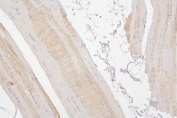 IHC staining of FFPE human skeletal muscle with Tafazzin antibody. HIER: boil tissue sections in pH6, 10mM citrate buffer, for 20 min and allow to cool before testing.