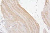 IHC staining of FFPE human skeletal muscle with Tafazzin antibody. HIER: boil tissue sections in pH6, 10mM citrate buffer, for 20 min and allow to cool before testing.