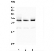 Western blot testing of 1) rat skeletal muscle, 2) mouse skeletal muscle and 3) mouse HEPA1-6 lysate with Tafazzin antibody. Expected molecular weight ~33 kDa.