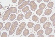 IHC staining of FFPE rat testis with Tafazzin antibody. HIER: boil tissue sections in pH6, 10mM citrate buffer, for 20 min and allow to cool before testing.