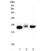 Western blot testing of 1) rat brain, 2) rat thymus and 3) mouse brain lysate with CD90 antibody. Expected molecular weight 18~35 kDa depending on glycosylation level.