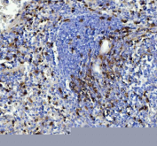 Immunohistochemical staining of FFPE mouse spleen tissue with CD90 antibody, HRP-secondary and DAB substrate. HIER: boil tissue sections in pH8 EDTA for 20 min and allow to cool before testing.