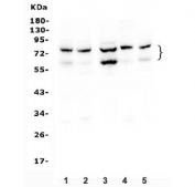 Western blot testing of human 1) HeLa, 2) Caco-2, 3) HepG2, 4) A549 and 5) K562 cell lysate with PCSK9 antibody. Predicted molecular weight: pro/mature form ~74/64 kDa.