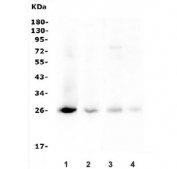 Western blot testing of 1) human SK-OV-3, 2) human 22RV1, 3) rat ovary and 4) mouse ovary lysate with TIMP1 antibody. Expected molecular weight: 23-28 kDa depending on the level of glycosylation.