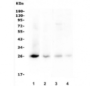 Western blot testing of 1) human SK-OV-3, 2) human 22RV1, 3) rat ovary and 4) mouse ovary lysate with TIMP1 antibody. Expected molecular weight: 23-28 kDa depending on the level of glycosylation.