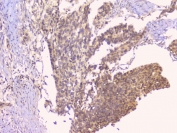 IHC staining of FFPE human oesophagus squama with TNFRSF11B antibody. HIER: boil tissue sections in pH6, 10mM citrate buffer, for 20 min and allow to cool before testing.