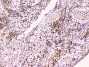 IHC staining of FFPE human appendicitis tissue with TNFRSF11B antibody. HIER: boil tissue sections in pH6, 10mM citrate buffer, for 20 min and allow to cool before testing.