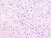 IHC staining of FFPE rat brain with TNFRSF11B antibody. HIER: boil tissue sections in pH6, 10mM citrate buffer, for 20 min and allow to cool before testing.