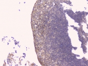 IHC staining of FFPE human tonsil with TNFRSF11B antibody. HIER: boil tissue sections in pH6, 10mM citrate buffer, for 20 min and allow to cool before testing.