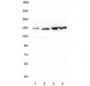Western blot testing of human 1) A549, 2) U-2 OS, 3) HEK293 and 4) K562 cell lysate with TOP2A antibody. Expected molecular weight ~174 kDa.