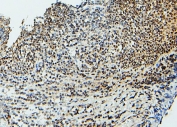 IHC staining of FFPE human tonsil with UBC9 antibody. HIER: boil tissue sections in pH6, 10mM citrate buffer, for 20 min and allow to cool before testing.