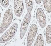 IHC staining of FFPE rat testis with UBC9 antibody. HIER: boil tissue sections in pH6, 10mM citrate buffer, for 20 min and allow to cool before testing.