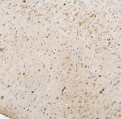 IHC staining of FFPE mouse brain with MTR antibody. HIER: boil tissue sections in pH6, 10mM citrate buffer, for 20 min and allow to cool before testing.